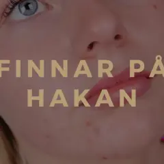 När finnar på hakan dyker upp kan det kännas jobbigt. Bilden visar en närbild på en persons haka med synliga finnar.