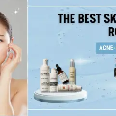 Ansiktsmodell med klar hud bredvid Reform Skincare-produkter för aknebenägen hud. Vanliga moln syns i bakgrunden.