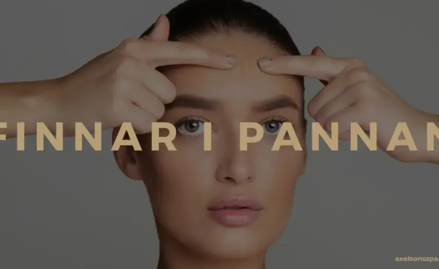 Finnar i pannan - Orsaker, behandling & när du söker vård